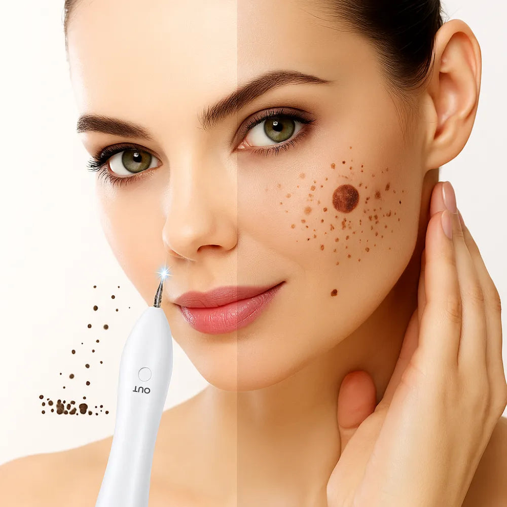 Cauterizador de Verrugas y Manchas