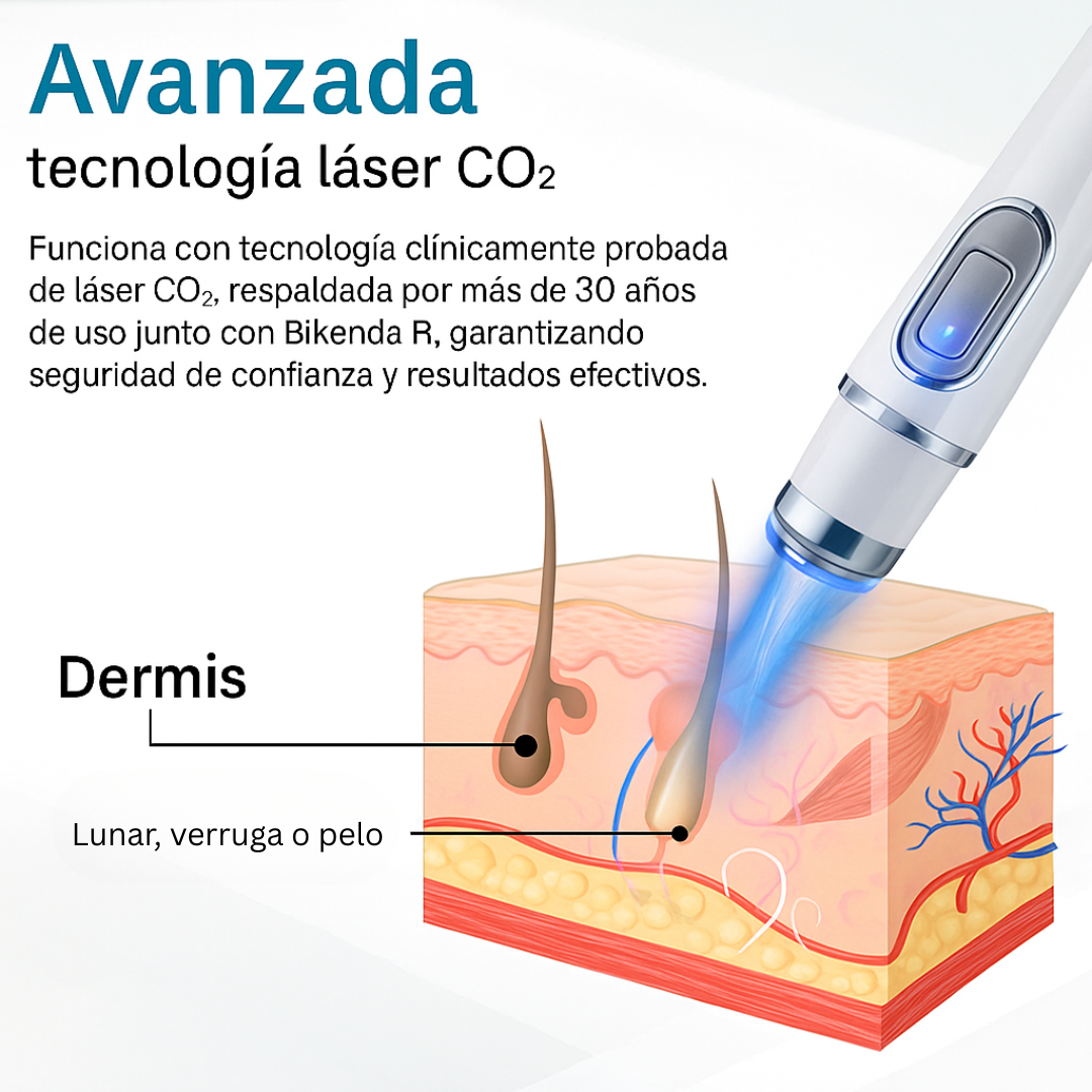 Lápiz Láser : Ayuda a mejorar la apariencia de verrugas y marcas en casa