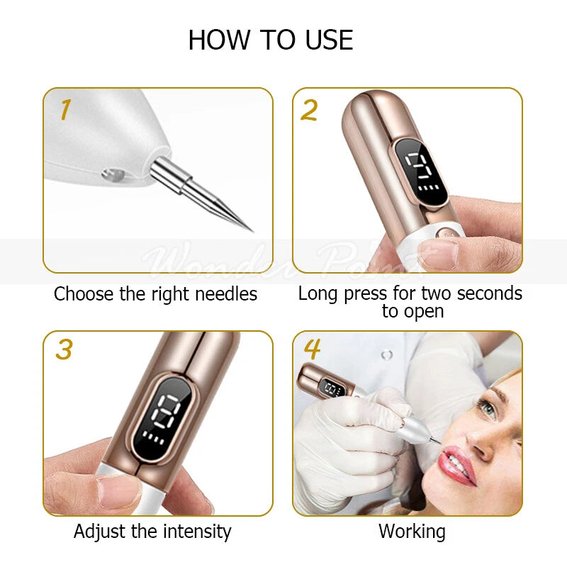 Cauterizador de Verrugas y Manchas